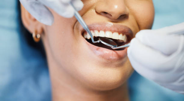 Best Emergency Dentist for Knocked-Out Tooth in Troy, MO