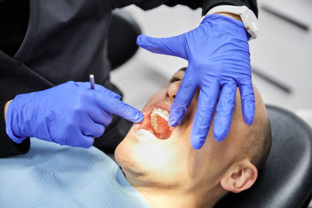 Best Emergency Dentist for Knocked-Out Tooth in Troy, MO